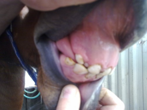 teeth oct